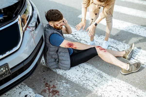 A man was struck by a car and now needs a Greenville pedestrian accident lawyer.